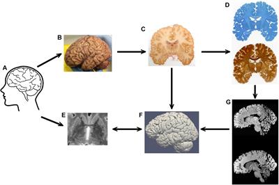 Frontiers | 7 Tesla MRI Followed by Histological 3D